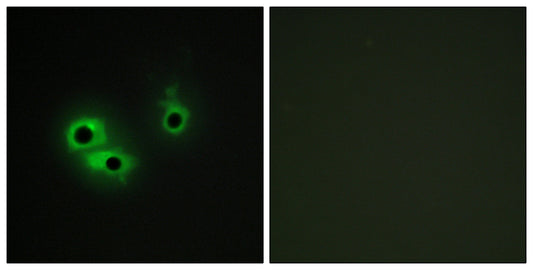 AGR3 Rabbit Polyclonal Antibody