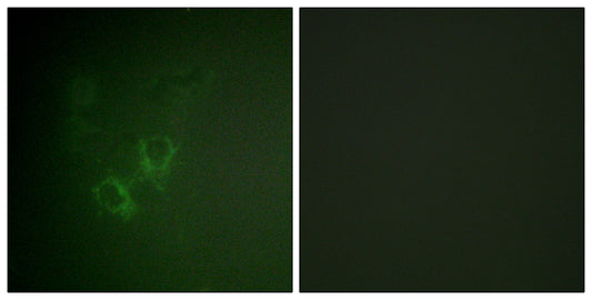 Ah Receptor Rabbit Polyclonal Antibody