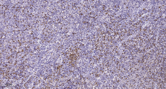 AHNK Rabbit Polyclonal Antibody