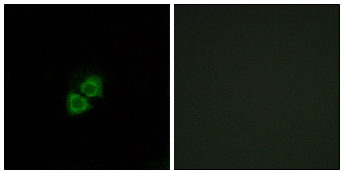 AI-BP Rabbit Polyclonal Antibody