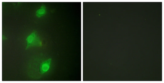 AIRE-1 Rabbit Polyclonal Antibody