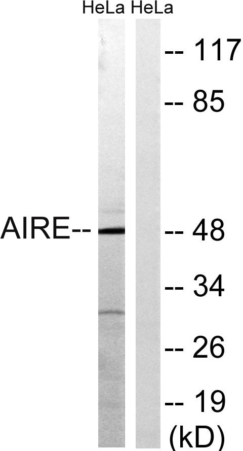 AIRE-1 Rabbit Polyclonal Antibody