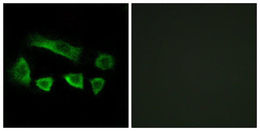 AIRP Rabbit Polyclonal Antibody