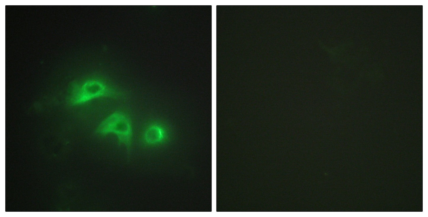 AK1 Rabbit Polyclonal Antibody