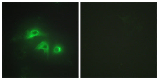 AK1 Rabbit Polyclonal Antibody
