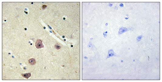 AK5 Rabbit Polyclonal Antibody
