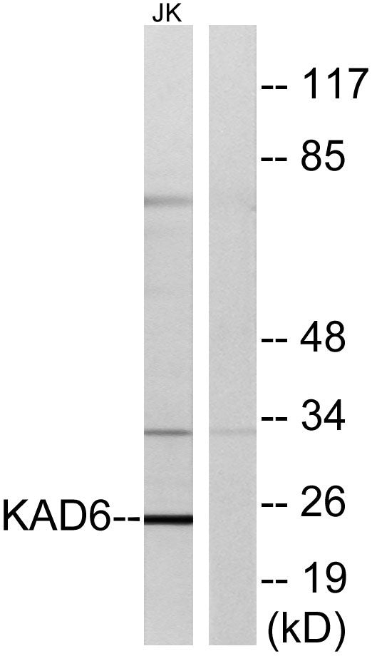 AK6 Rabbit Polyclonal Antibody