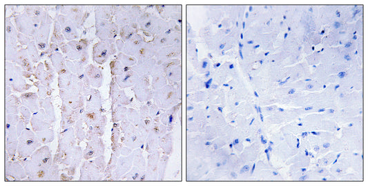 AKAP 13 Rabbit Polyclonal Antibody