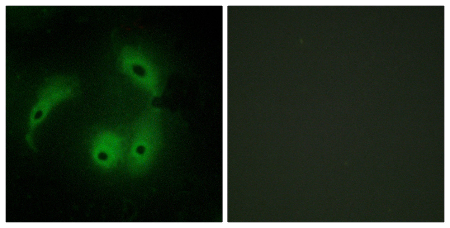 AKAP 14 Rabbit Polyclonal Antibody
