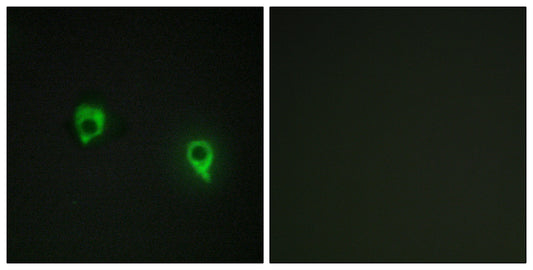 AKAP 149 Rabbit Polyclonal Antibody