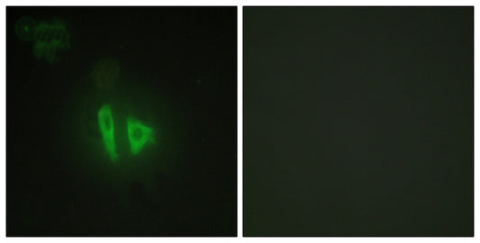 AKAP 220 Rabbit Polyclonal Antibody