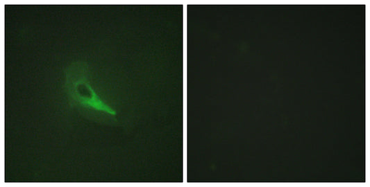 AKAP 250 Rabbit Polyclonal Antibody