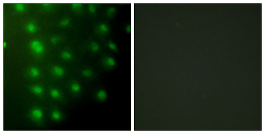 AKAP 95 Rabbit Polyclonal Antibody