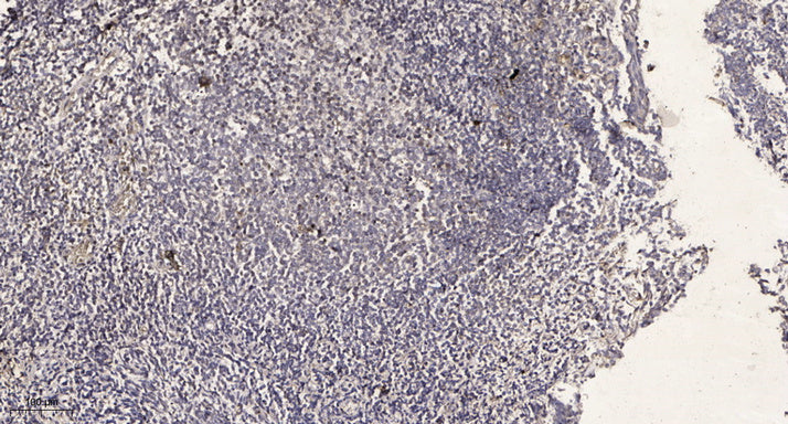 AKAP6 Rabbit Polyclonal Antibody