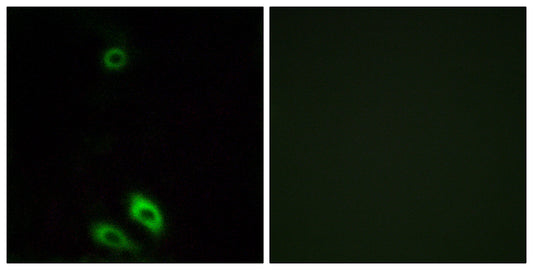 AKR1CL1 Rabbit Polyclonal Antibody