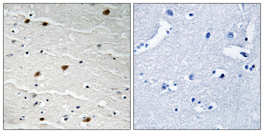 Akt Rabbit Polyclonal Antibody