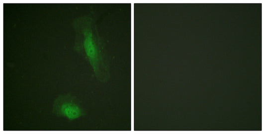 Akt1 Rabbit Polyclonal Antibody
