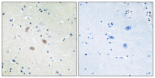 Akt2 Rabbit Polyclonal Antibody