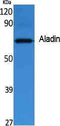 Aladin Rabbit Polyclonal Antibody