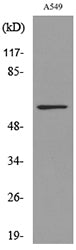 ALDH2 Rabbit Polyclonal Antibody
