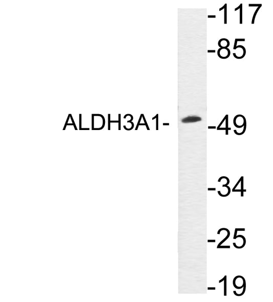 ALDH3A1 Rabbit Polyclonal Antibody