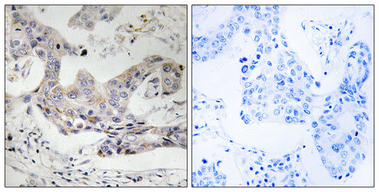 ALDH3B1 Rabbit Polyclonal Antibody