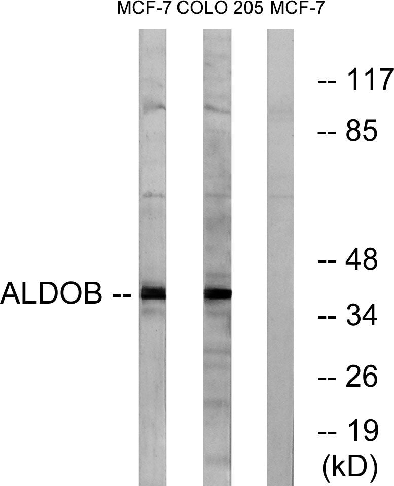 Aldolase B Rabbit Polyclonal Antibody