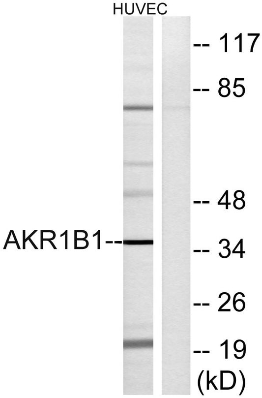 Aldose Reductase Rabbit Polyclonal Antibody
