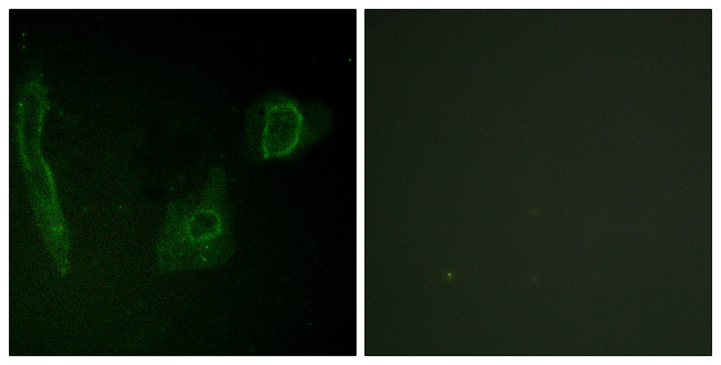 ALK Rabbit Polyclonal Antibody