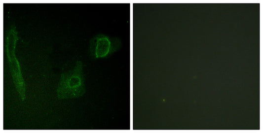 ALK Rabbit Polyclonal Antibody