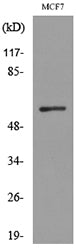 ALK-1 Rabbit Polyclonal Antibody
