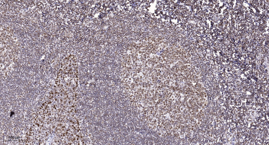 ALKBH5 Rabbit Polyclonal Antibody
