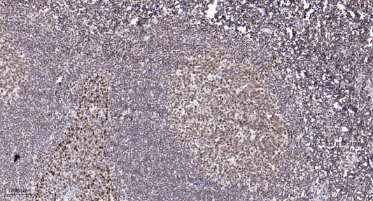 ALKBH5 Rabbit Polyclonal Antibody