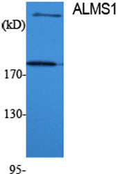 ALMS1 Rabbit Polyclonal Antibody