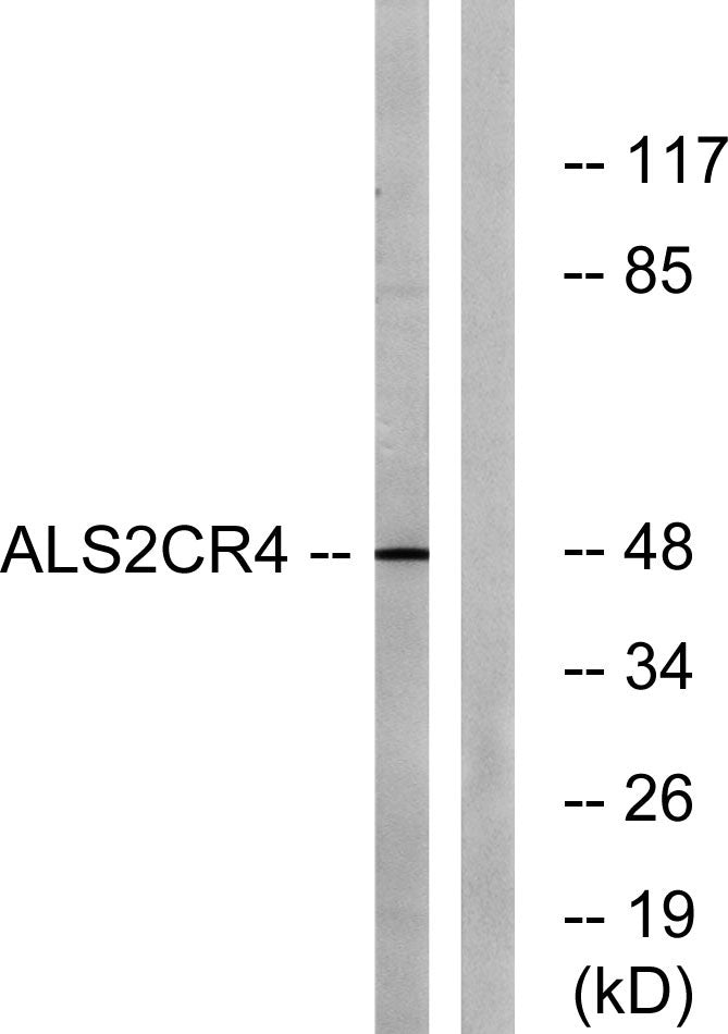 ALS2CR4 Rabbit Polyclonal Antibody