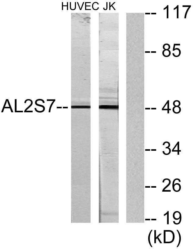 ALS2CR7 Rabbit Polyclonal Antibody
