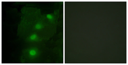 ALX3 Rabbit Polyclonal Antibody