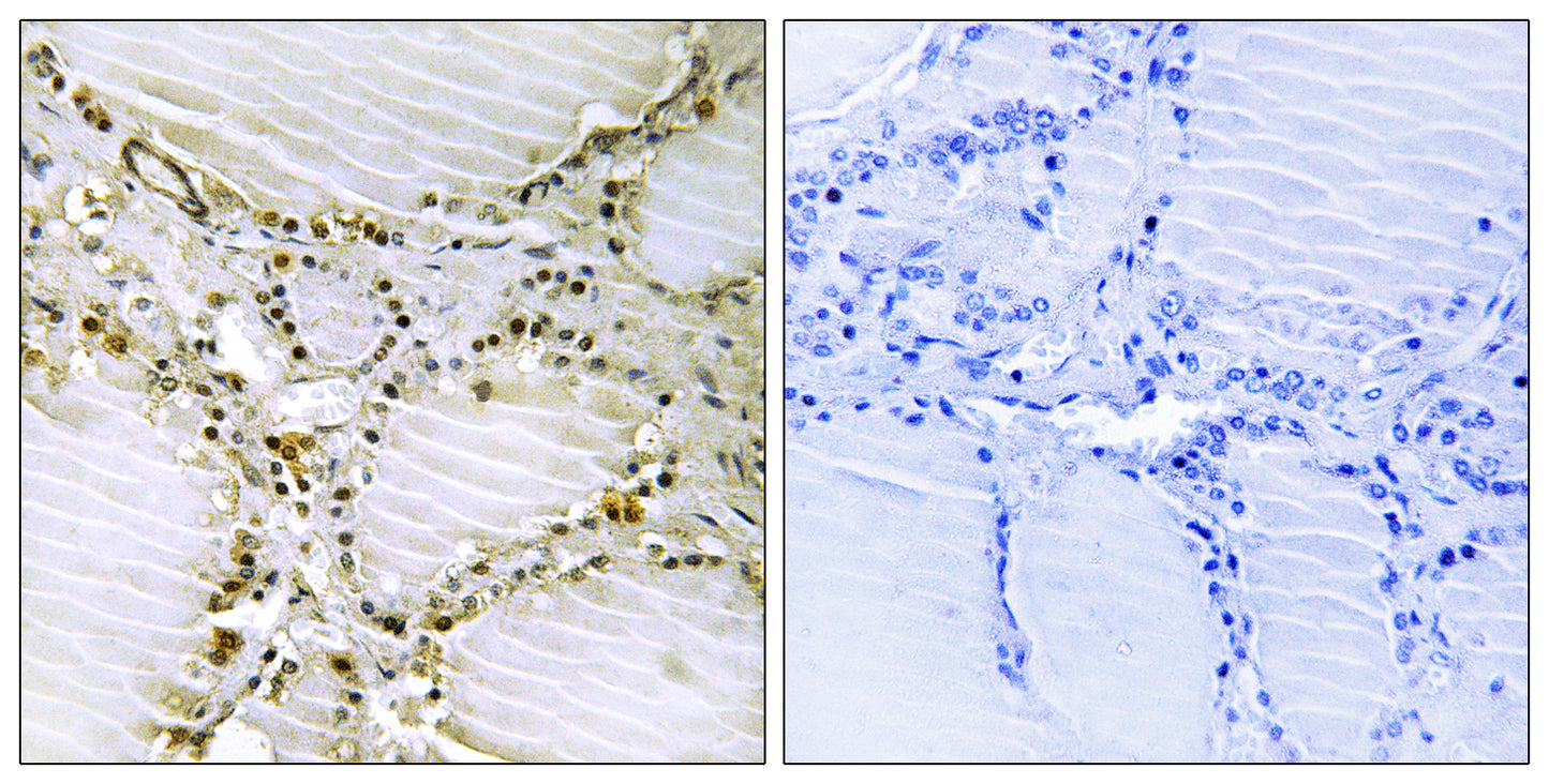 AMPD1 Rabbit Polyclonal Antibody
