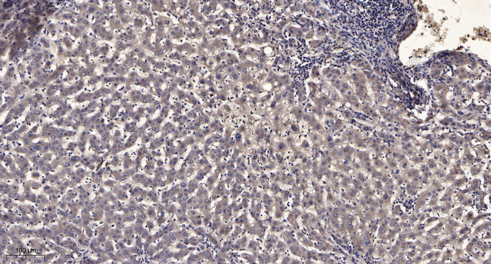 AMPD3 Rabbit Polyclonal Antibody