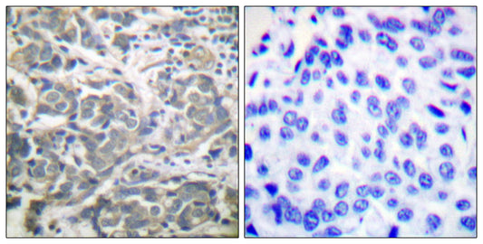 AMPKα1/2 Rabbit Polyclonal Antibody