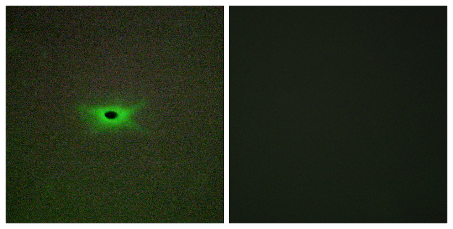 AMPKγ2 Rabbit Polyclonal Antibody
