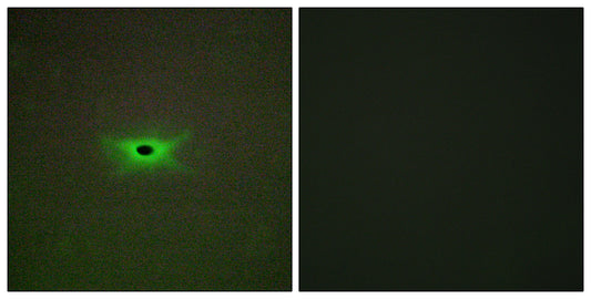 AMPKγ2 Rabbit Polyclonal Antibody