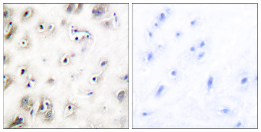 Amylin Rabbit Polyclonal Antibody