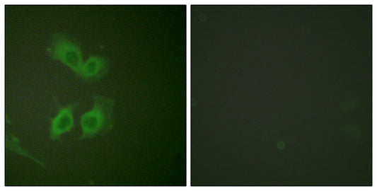 Amyloid-β Rabbit Polyclonal Antibody