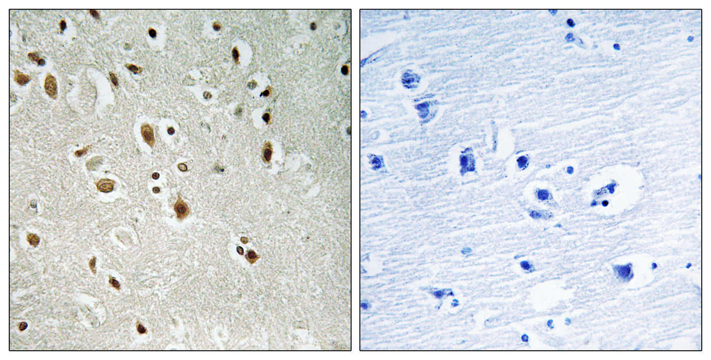 ANKRD20 Rabbit Polyclonal Antibody