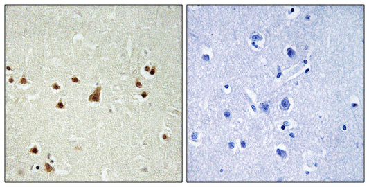 ANKRD26 Rabbit Polyclonal Antibody