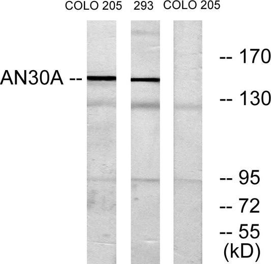 ANKRD30A Rabbit Polyclonal Antibody