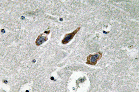Annexin II Rabbit Polyclonal Antibody