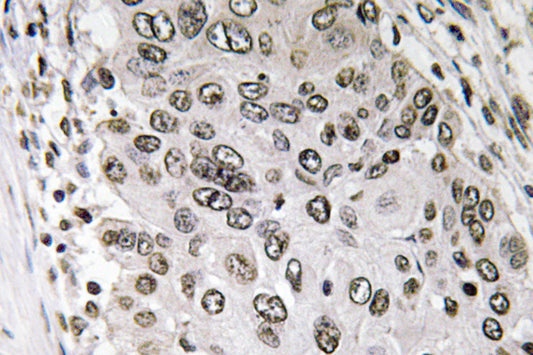 Annexin III Rabbit Polyclonal Antibody