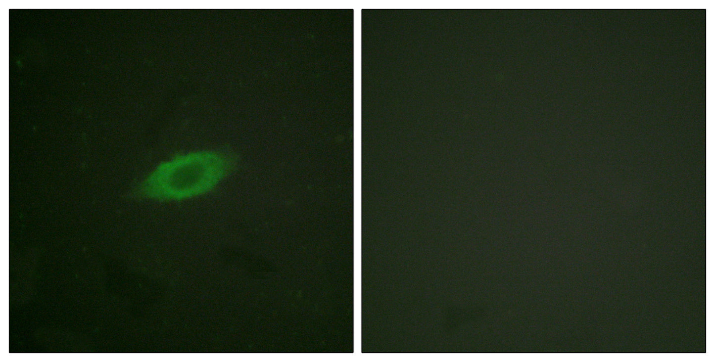 Annexin VI Rabbit Polyclonal Antibody
